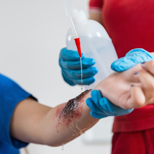 Soignez vos brûlures avec biafine, le médicament idéal